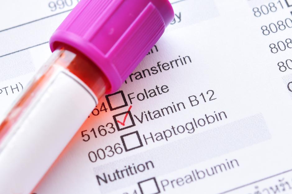 Vitamin B12 | Author: shutterstock
