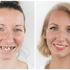 Bez obzira na vaše dentalno stanje, rješenje za novi osmijeh uvijek postoji
