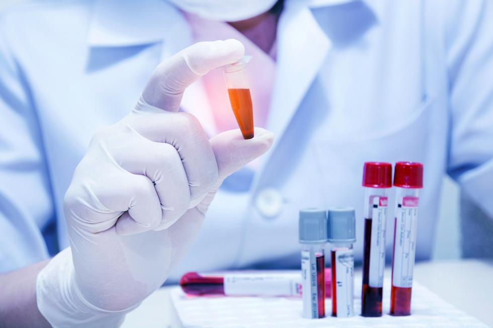 Znanstvenici pronašli test krvi koji otkriva rak prije pojave simptoma