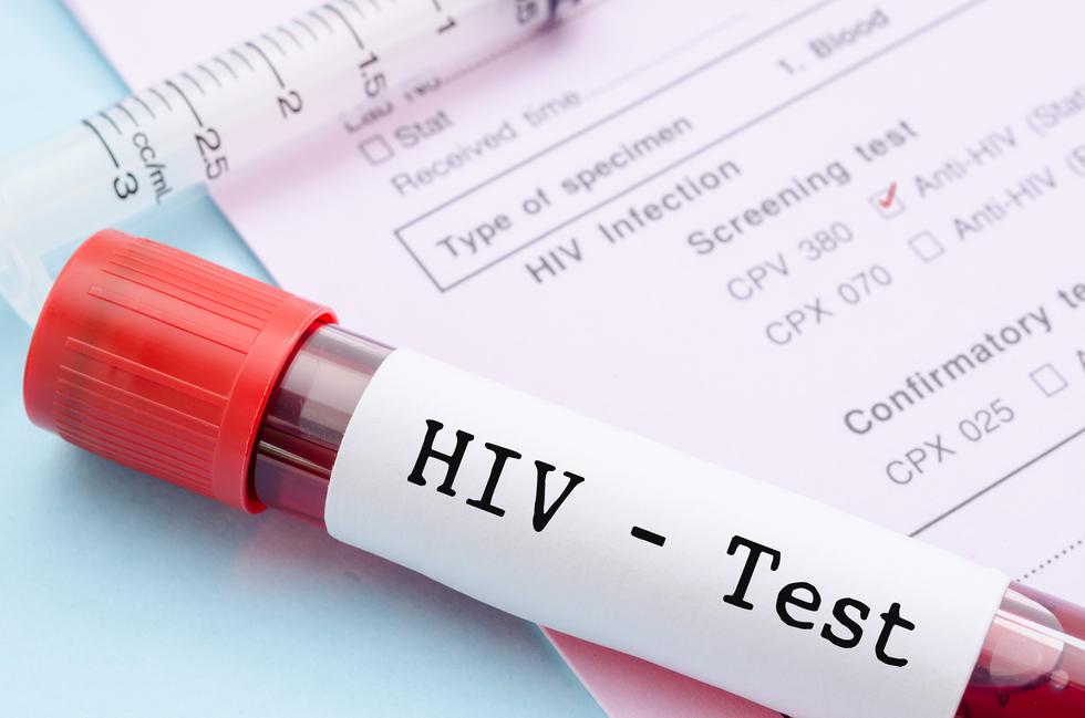 HIV: U Hrvatskoj se epidemija može u potpunosti spriječiti, ako se testira na vrijeme