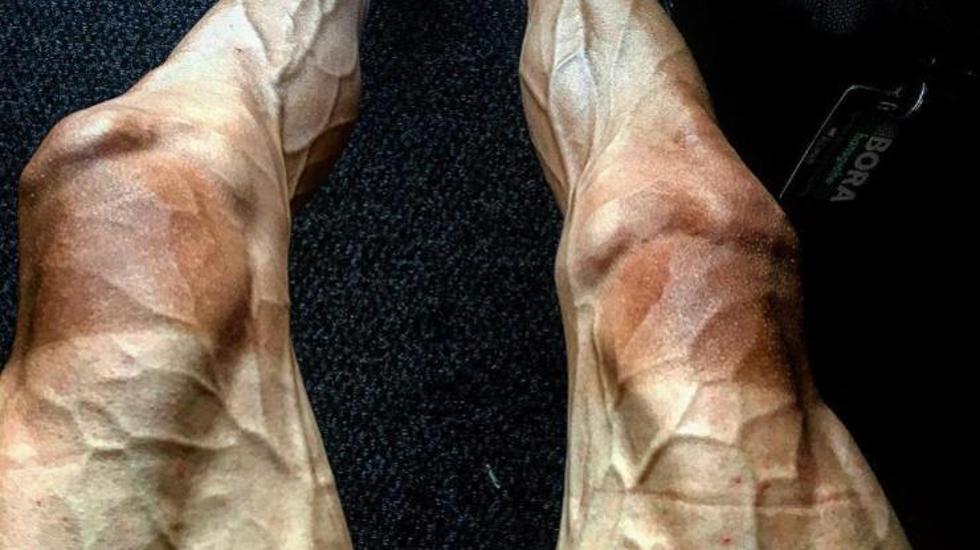Ovako noge izgledaju nakon Tour de Francea