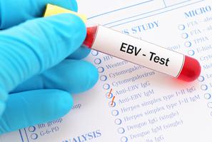 Epstein-Barr virus