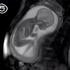 Nevjerojatan video: Ovaj fetus trenira od 'malih nogu'