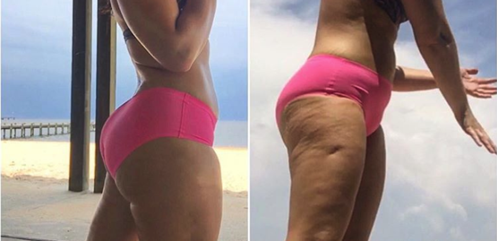 Instagram influencerica otkrila kako osvjetljenje mijenja izgled nogu na slikama