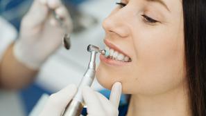 poliranje zubi stomatolog