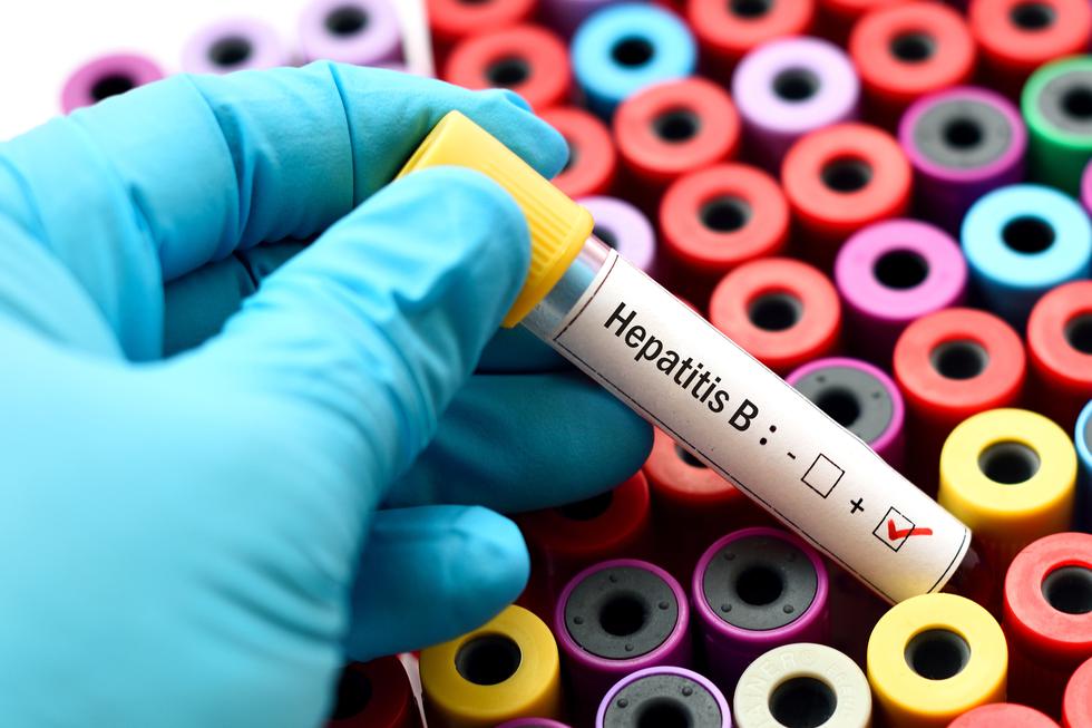 Što se može dogoditi ako ne liječiš hepatitis?