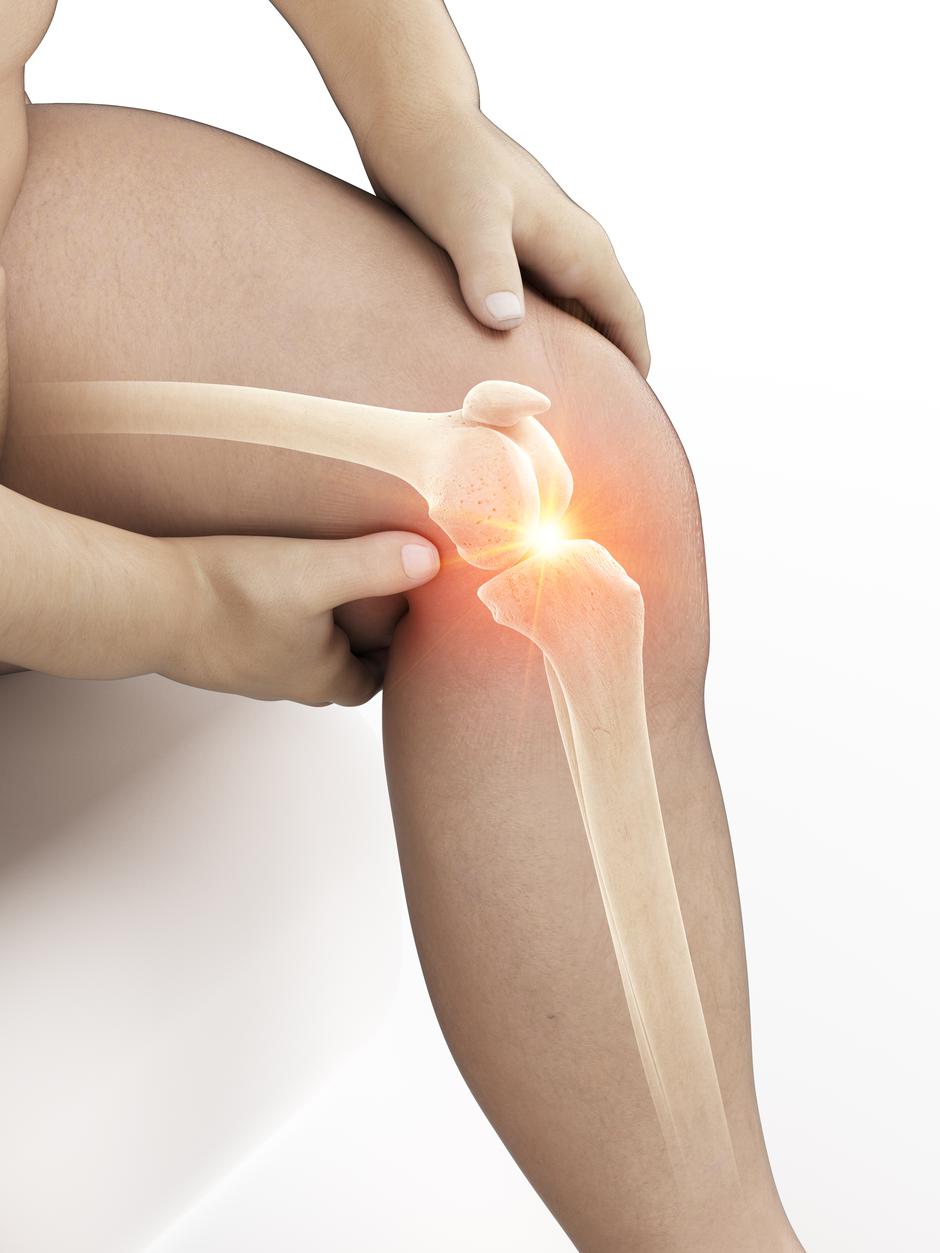 bol u zglobovima koljena i mišića