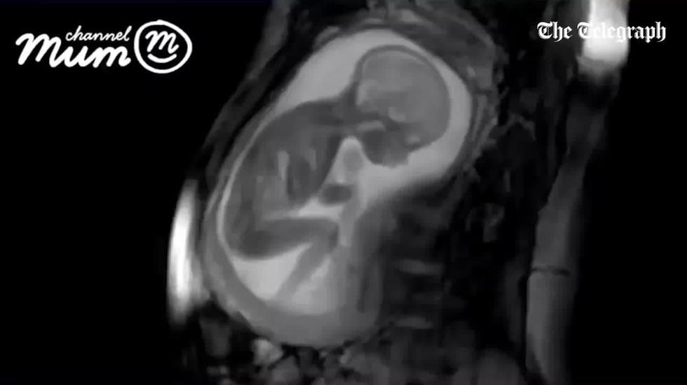Nevjerojatan video: Ovaj fetus trenira od 'malih nogu'