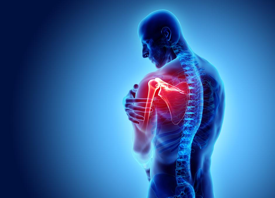 Bolovi u zglobu ramena: simptomi, dijagnoza i liječenje - Miozitis - 