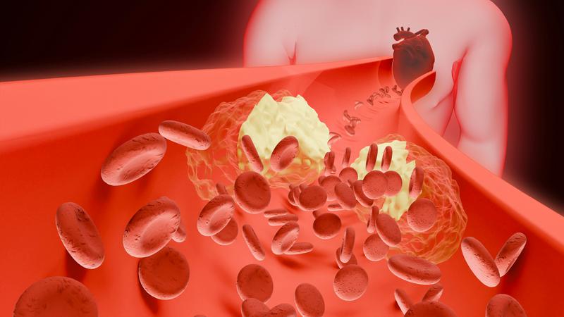 Znanstvenici kona&ccaron;no rije&scaron;ili misterij rijetkih krvnih ugru&scaron;aka povezanih s cjepivima protiv covida