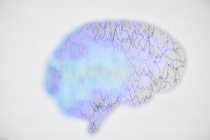 epilepsija
