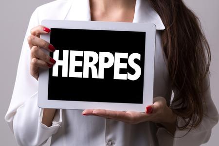 Na i herpes seks usnama oralni Herpes na